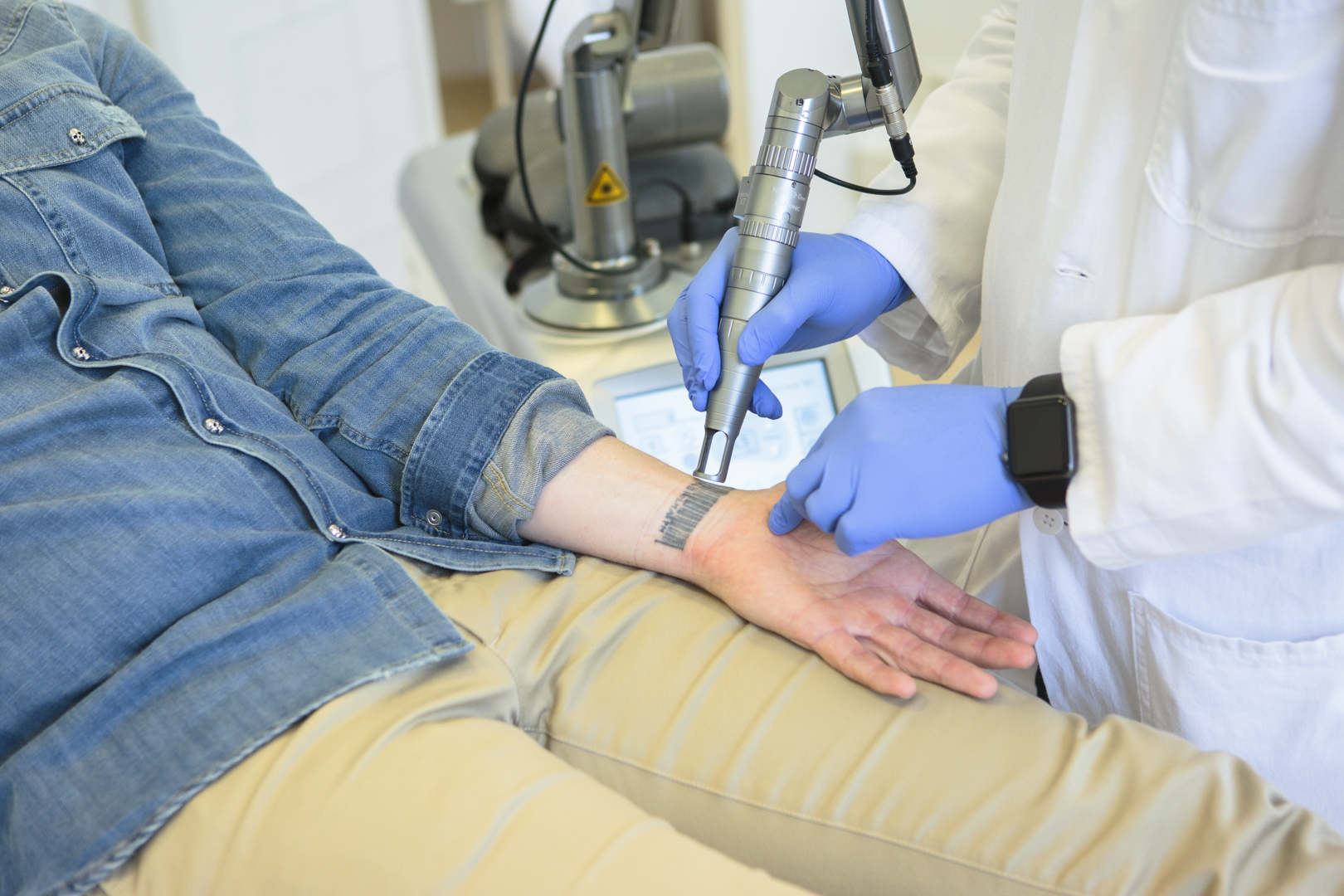 Détatouage laser Détatouage laser